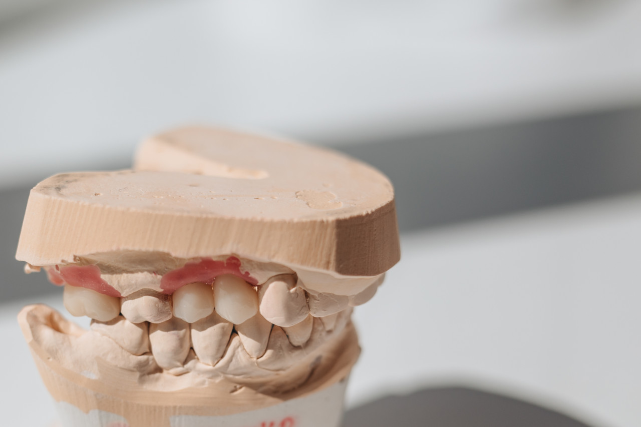 jaw model