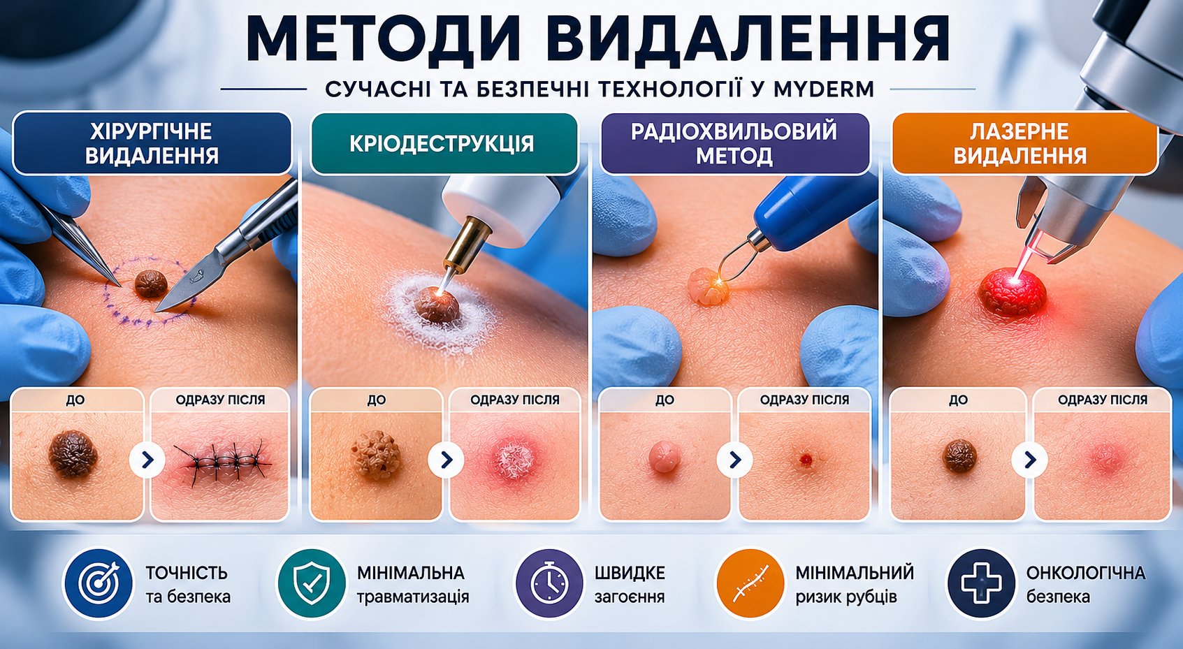 myderm-pic-2